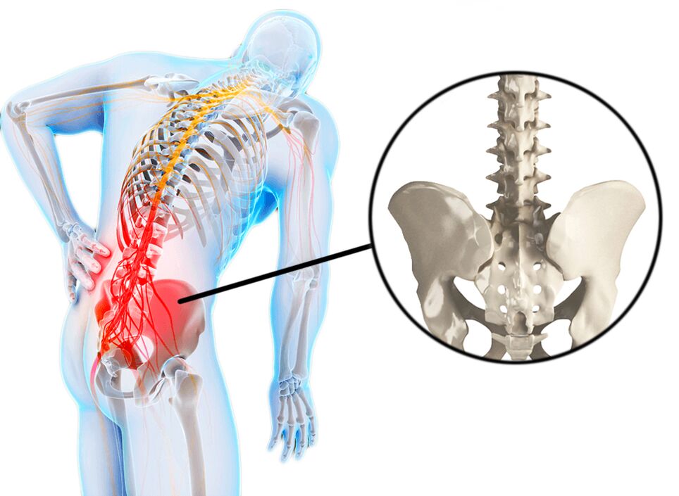 Patologias da coluna vertebral são uma causa comum de dor lombar