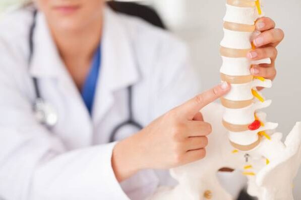 osteocondrose
