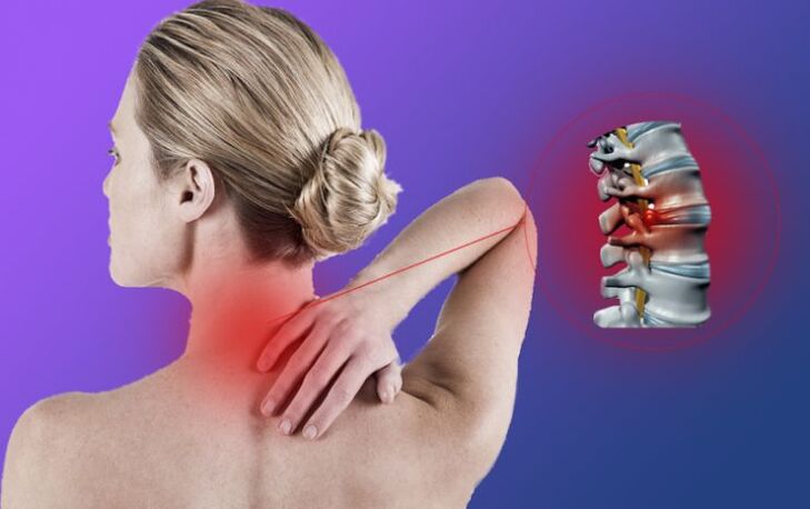 Inflamação da coluna com osteocondrose cervical