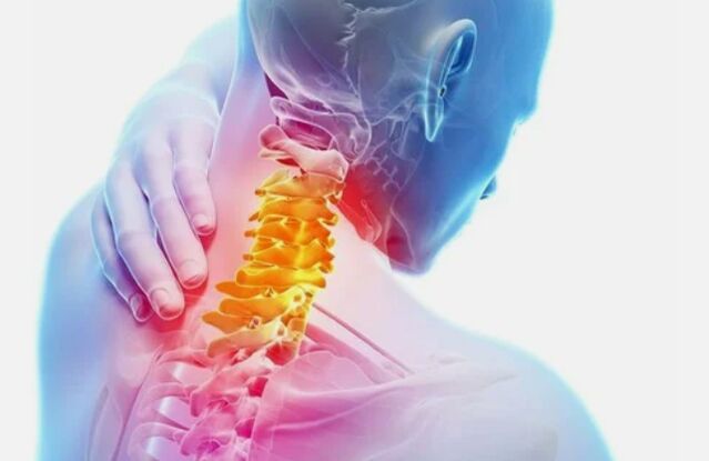Osteocondrose da região cervical