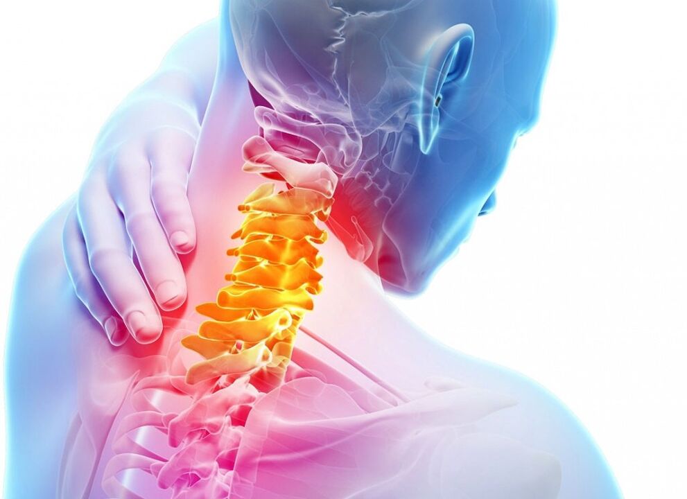 O que é osteocondrose cervical