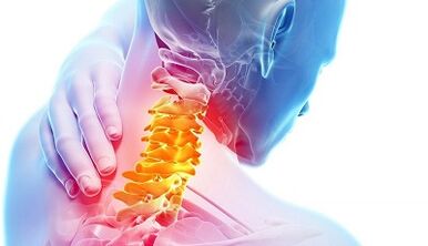 causas de osteocondrose cervical