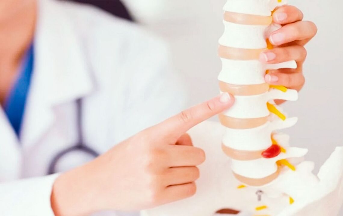 danos à coluna devido à osteocondrose cervical