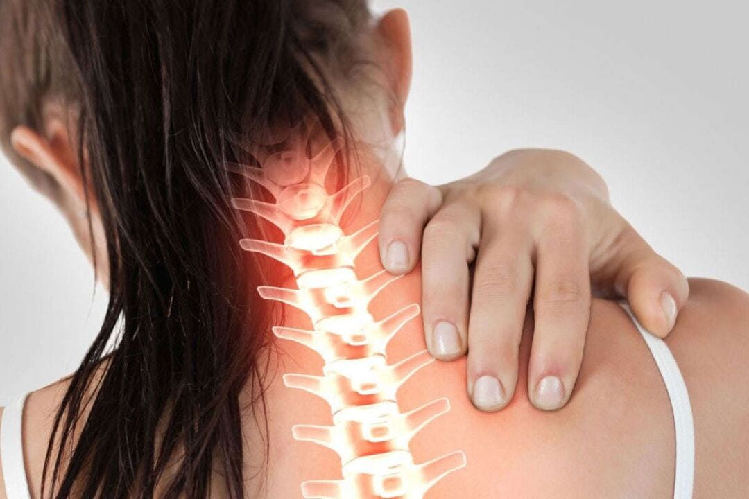 Manifestações de osteocondrose cervical